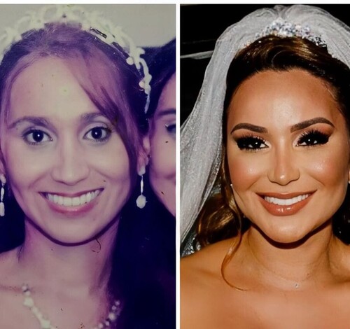 As técnicas de rejuvenescimento facial mais procuradas na atualidade