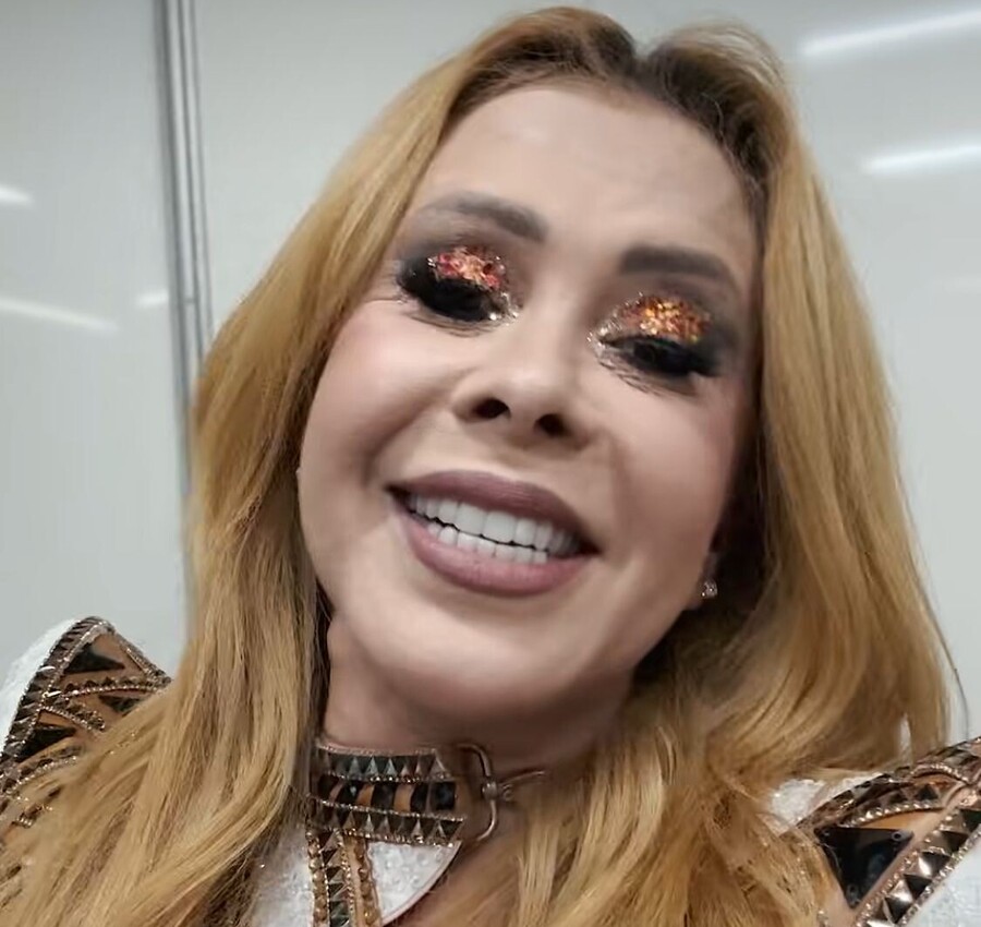 A internação de Joelma tem reviravolta e preocupa médicos 