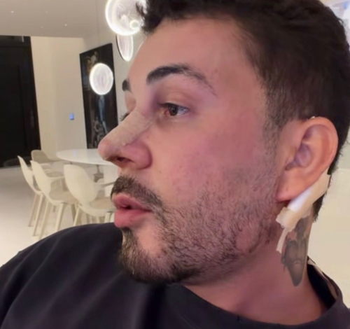 Carlinhos Maia aposta em retoque no visual para segurar aparência jovial