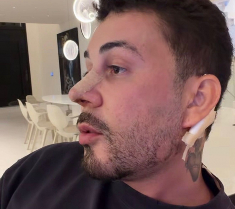 Carlinhos Maia aposta em retoque no visual para segurar aparência jovial